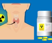 la-terapia-con-radio-iodio-delle-malattie-benigne-della-tiroide