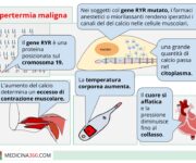 lipertermia-maligna-una-tempesta-metabolica-scatenata-dallanestesia