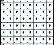 La valutazione del tempo di transito esofageo e del reflusso gastro-esofageo in medicina nucleare Reflusso gastroesofageo