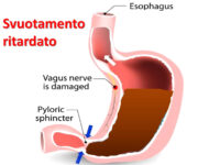 svuotamento